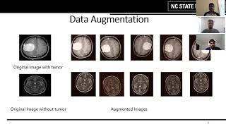 Brain Tumor Detection using Convolutional Neural Network [upl. by Raseda]