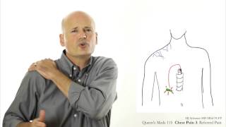 Chest Pain 3 Referred pain [upl. by Asiil]