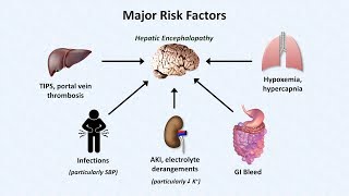 Hepatic Encephalopathy [upl. by Stultz]