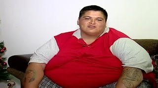 Joven que sufre obesidad mórbida extrema bajó más de 80 kilos  CHV Noticias [upl. by Annahsar]