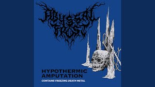 Hypothermic Amputation [upl. by Washburn]