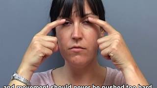 Eye Exercises during the Paresis stage of facial palsy [upl. by Lonee]