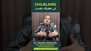 What are the danger signs of chilblains  چلبلینز کے خطرے کی علامات؟  Dr Tanveer Arshad Ch [upl. by Codding661]