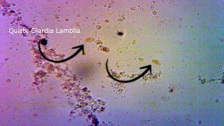 Blastocystis hominis y Giardia lamblia 1  Quistes  Microscope 40x Lugol Copro  Pura Ciencia [upl. by Bible]