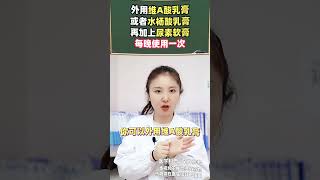 女生大腿内侧黑黑的，“穿短裙的尴尬”你有经历过吗？色素沉着变白医学科普 [upl. by Elleinnad651]