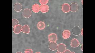 Babesia bovis merozoite egress from a red blood cell [upl. by Shalne869]