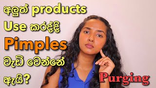 Reasons To Get Pimples When You Start Using A New Product In Sinhala  Purging Vs Pimples In Sinhala [upl. by Grannia]