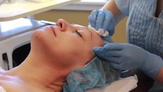 Micropeel Demonstration [upl. by Feldt]