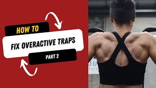 How To Fix Overactive Traps PART 2 [upl. by Donelson249]