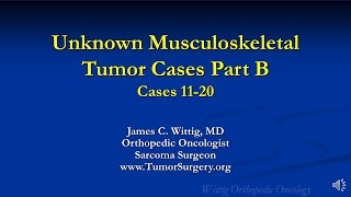 Orthopedic Oncology Course  Unknown Test Cases Part B Cases 1120  Lecture 12 [upl. by Aseefan]