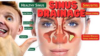 Natural sinus drainage swollen lymph nodes blocks the passage tutorial [upl. by Roscoe]