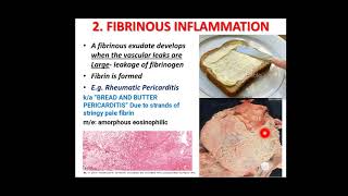 INFLAMMATION PART 6 Acute inflammation outcomes and morphological patterns [upl. by Annaynek]