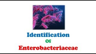 Microbiology 🔤  Biochemical Tests and Identification of Enterobacteriaceae [upl. by Rosenzweig]