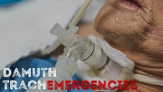 Tracheostomy Emergencies [upl. by Salot368]