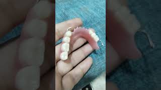 Removable Partial Denture 😁😁 [upl. by Frieda960]