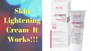 Depiwhite Cream Review IT WORKS [upl. by Anairo]