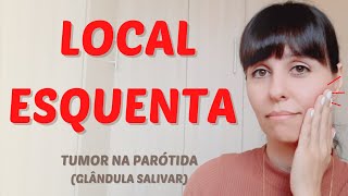 Esquenta o local  tumor na parótida [upl. by Goldenberg]