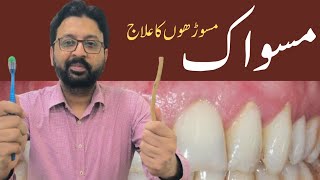 How to Use MISWAK to Heal Gum Recession [upl. by Akcemat]