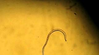 Strongyloides stercoralis filariform larvae [upl. by Cleodell]