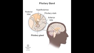 Pathology of Anterior and Posterior Pituitary Gland Pathoma Lectures word by word explained [upl. by Waltner665]