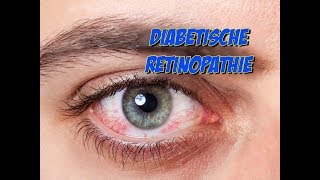 Erkrankungen der Augen  Diabetische Retinopathie [upl. by Acinomal]