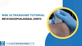 MSK ultrasound evaluation of the metatarsophalangeal joints MTPJs in the foot [upl. by Ilrebmyk]