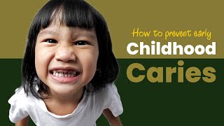 How to prevent Early Childhood Caries  Baby Bottle Tooth Decay [upl. by Erdnassak]