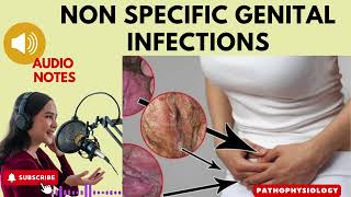 NonSpecific Genital Infections Causes Symptoms and Treatment Audio Notes [upl. by Assila]