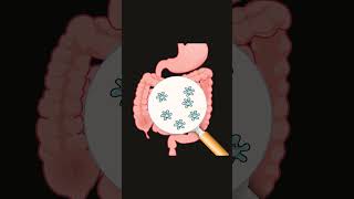 Correct your gut dysbiosis by following this step 👆🏻guthealth youtubeshorts [upl. by Ranson]