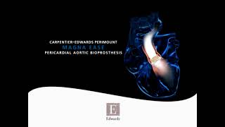 CarpentierEdwards PERIMOUNT Magna Ease aortic valve [upl. by Prem136]