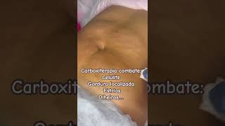 Carboxiterapia excelente tratamento para celulite gordura localizada flacidez de pele estrias [upl. by Zsazsa100]