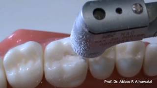 Class 2 cavity preparation for amalgam restorations 0 [upl. by Inalak]