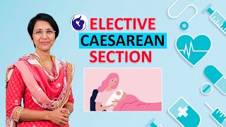 What is Elective C Section Cesarean section – Dr Rajeshwari Reddy Explains [upl. by Son]