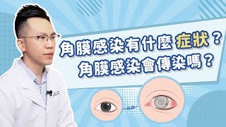 【角膜感染有什麼症狀？角膜感染會傳染嗎？】香港希瑪眼科中心  眼科QampA  尹浩柟眼科專科醫生 [upl. by Eylloh]