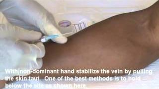 IV Insertion Video Demo 1 of 2mp4 [upl. by Bloch369]