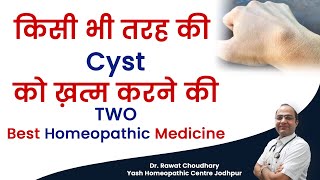 किसी भी तरह की गाँठ को ख़त्म करने की दवा  2 Homeopathic Medicines for any kind of Cyst [upl. by Narahs]