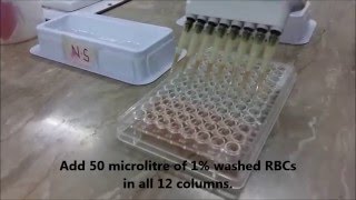 AJs Science 2 How to perform Hemagglutination assay HA Test [upl. by Clarie]