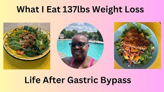 WHAT I EAT AFTER GASTRIC BYPASS I LOST 137 POUNDS [upl. by Jory]