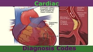 Common Cardiac Diagnosis Codes You Need To Know [upl. by Kenay]