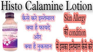 Histo calamine lotion uses in hindi स्किन एलर्जी की लोशन दवा skin allergy ki lotion dawaa [upl. by Crowns758]