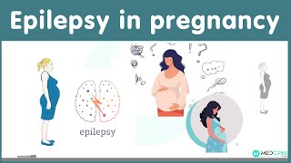 Epilepsy in pregnancy Causes Risks and management [upl. by Dionisio502]