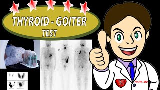 Thyroid Goiter Test RAIU  WHEN  WHAT IS IT [upl. by Ativet]