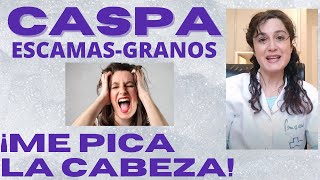 CASPA ESCAMAS Y GRANOS EN LA CABEZA ¿Te PICA la CABEZA🙆 [upl. by Notterb]