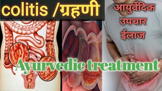 कोलाइटिस ग्रहणी का आयुर्वेदिक उपचारईलाज colitis treatment [upl. by Anaed]