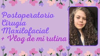 Postoperatorio de la cirugía maxilofacial I Parte 3 I Diario de una actriz I Vlog de mi rutina [upl. by Anirbes]