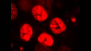 Recruitment of 53BP1 to DNA double strand breaks sites [upl. by Rossi]