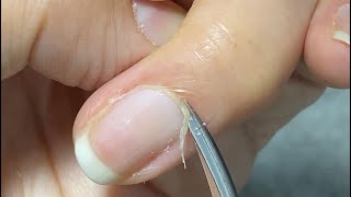 How to cut cuticles with scissors for cuticle carehow to use cuticle pusher and nipper [upl. by Nauqes]