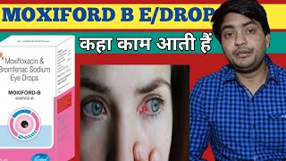 moxiford b eye drop use in hindi  moxiford b eye drop review [upl. by Riordan]