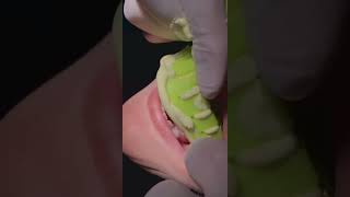 Alginate impression dentistteeth dentistry dental dentista fyp viral dentistteeth teethsmile [upl. by Aivila]