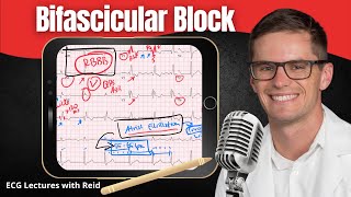 Bifascicular Blocks EKG  ECG Lecture [upl. by Coriss237]